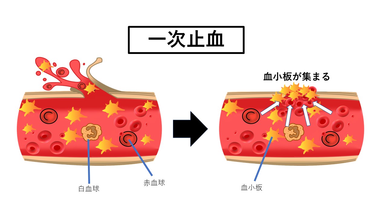 フィブリノーゲン血小板